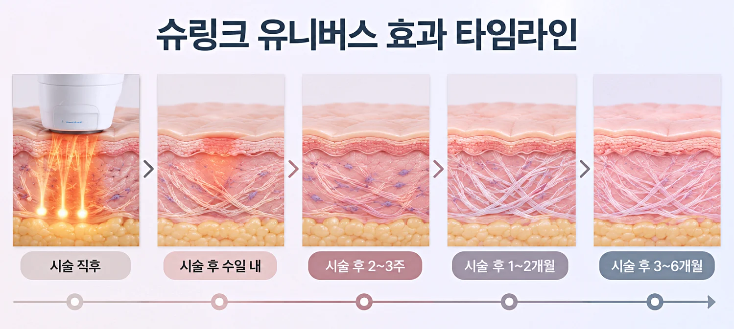 슈링크유니버스 효과 체감 시점과 유지 흐름을 보여주는 타임라인