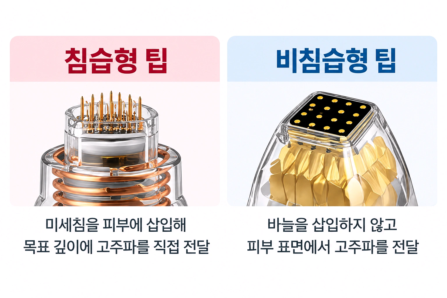 포텐자 침습형·비침습형 팁의 고주파 전달 방식 차이