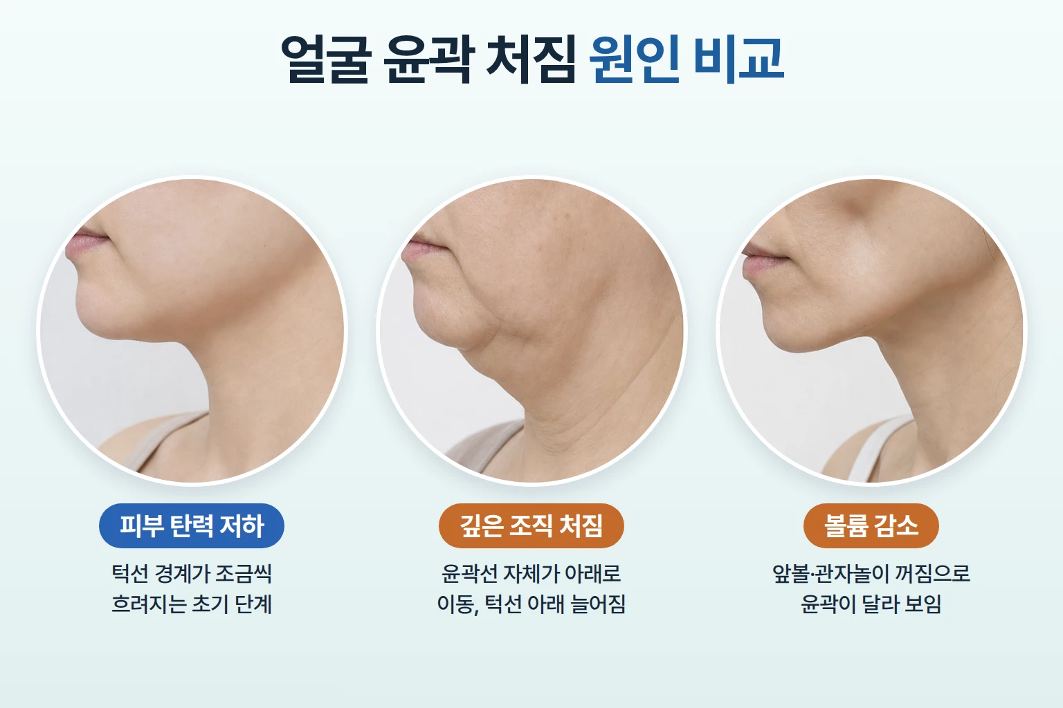 피부 탄력 저하와 깊은 조직 처짐, 볼륨 감소에 따른 하관 윤곽 차이
