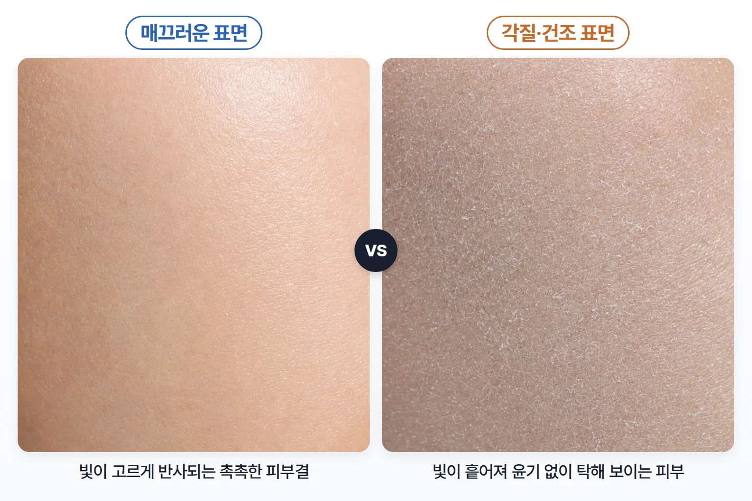 매끄러운 피부와 각질이 들뜬 건조한 피부의 표면 질감 및 빛 반사 차이로 나타나는 피부 윤기 변화