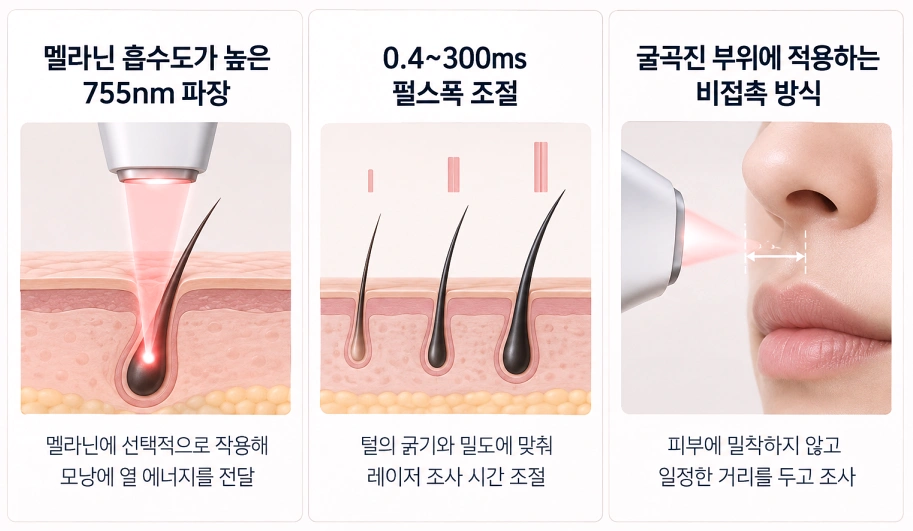 아포지플러스의 인중 제모 적용 방식
