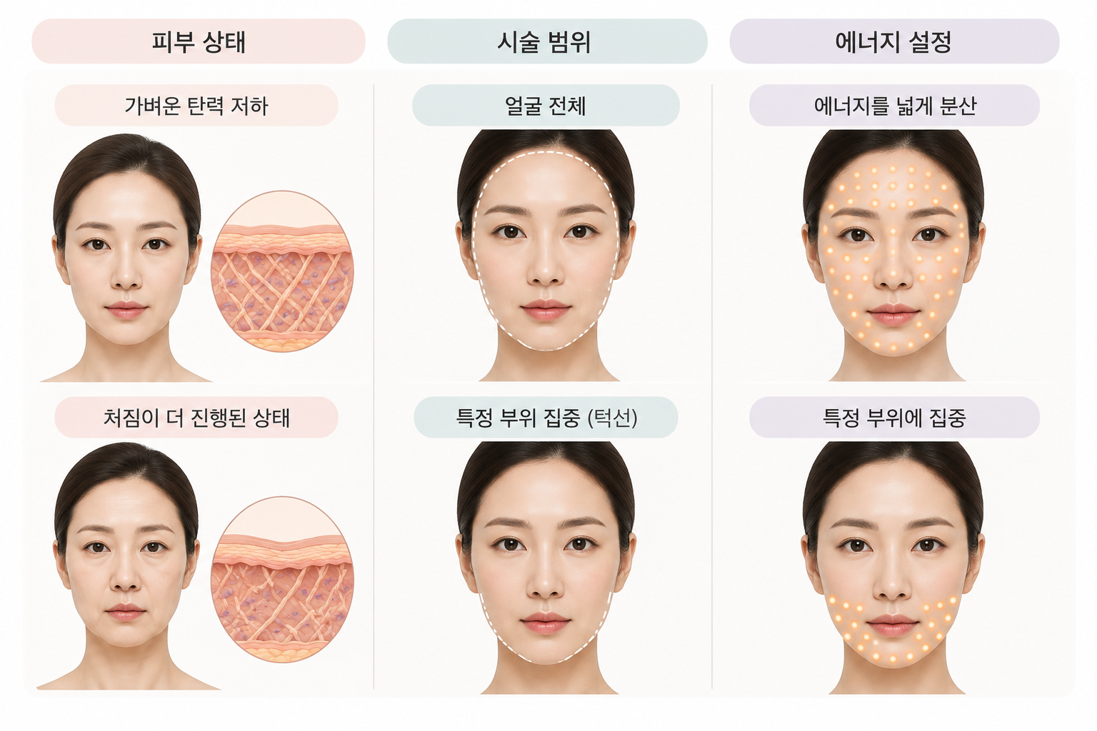 가벼운 탄력 저하와 처짐·볼륨 감소가 동반된 복합적인 처짐 상태 비교