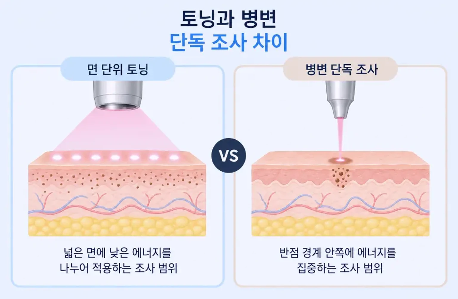 넓은 면 저에너지 반복 조사와 반점 한 곳 집중 조사의 범위 차이를 나란히 비교한 개념도
