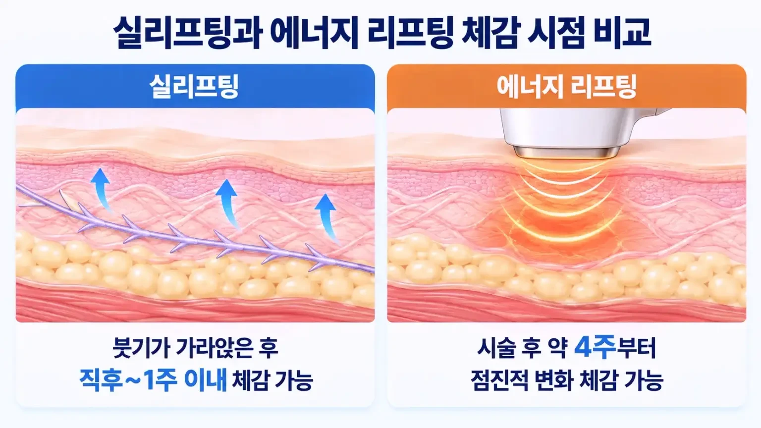 실리프팅과 에너지 리프팅 효과 체감 시점 및 차이 비교