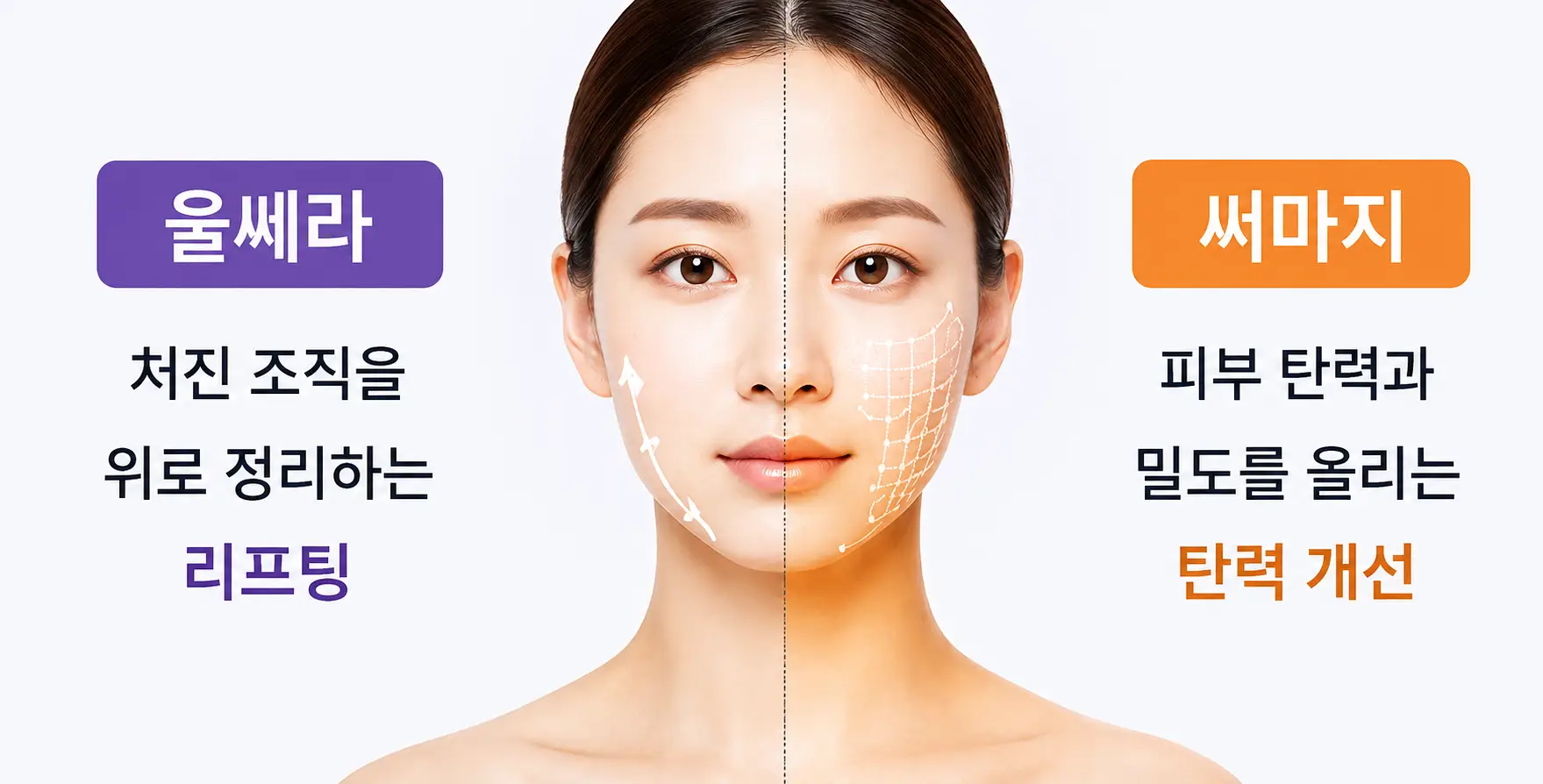 울쎄라 써마지 효과와 시술 목적에 따른 차이