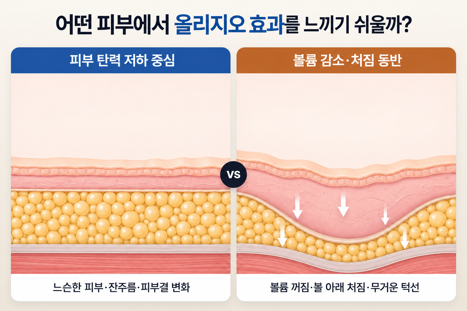 올리지오 효과를 느끼기 쉬운 피부 탄력 저하와 볼륨 감소·처짐 상태 비교