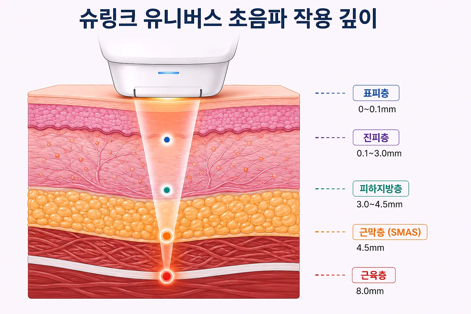 슈링크 유니버스 초음파 집속 깊이 단면도 - 카트리지별 타깃 층