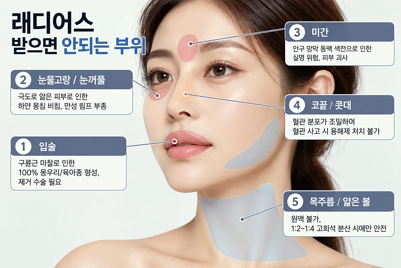 미간 눈물고랑 눈꺼풀 콧대 목주름 얇은볼 목 래디어스 부위별 시술 불가 부위를 나타낸 이미지