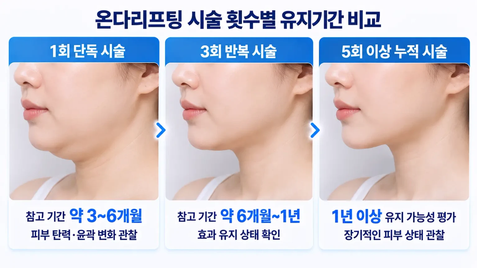 온다리프팅 이중턱 시술 횟수별 턱선 변화와 효과 유지기간 비교