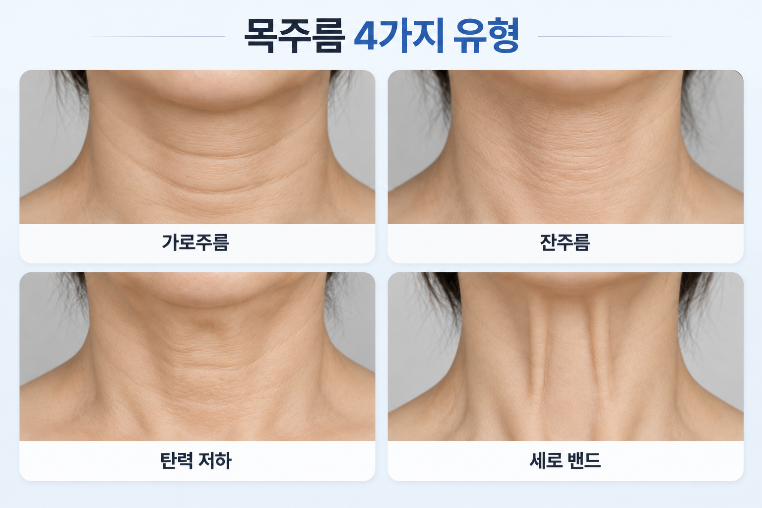 가로주름 잔주름 탄력 저하 세로 밴드의 목 피부 유형 비교