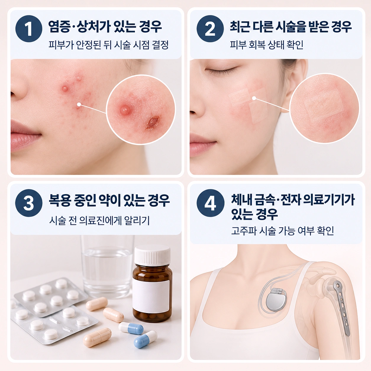 덴서티 리프팅 전 확인해야 할 주의사항