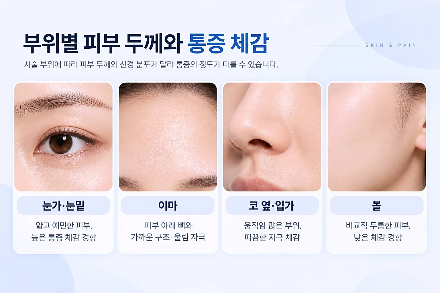 눈가·눈밑, 이마, 코 옆·입가, 볼의 피부 두께와 통증 체감 경향을 정리한 부위별 카드 이미지