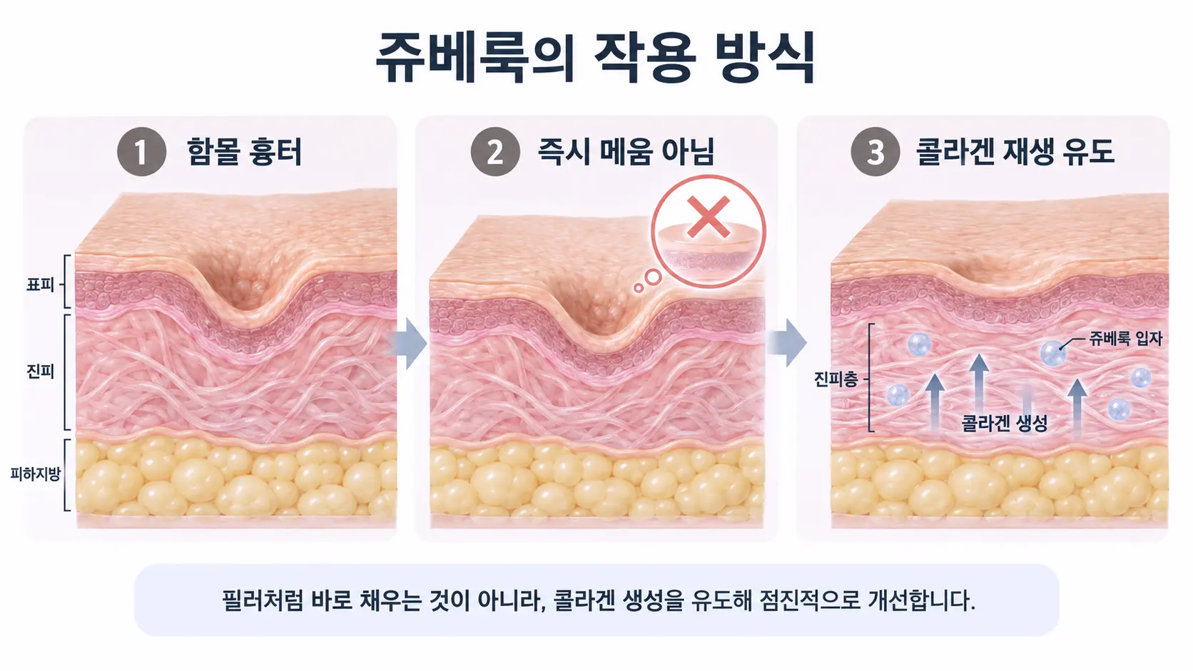 쥬베룩의 작용 방식