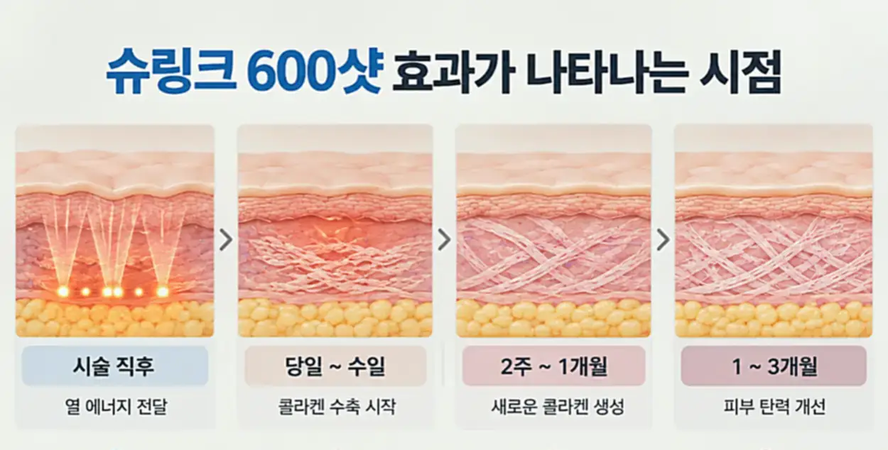 슈링크 600샷 피부 변화 타임라인을 정리한 이미지