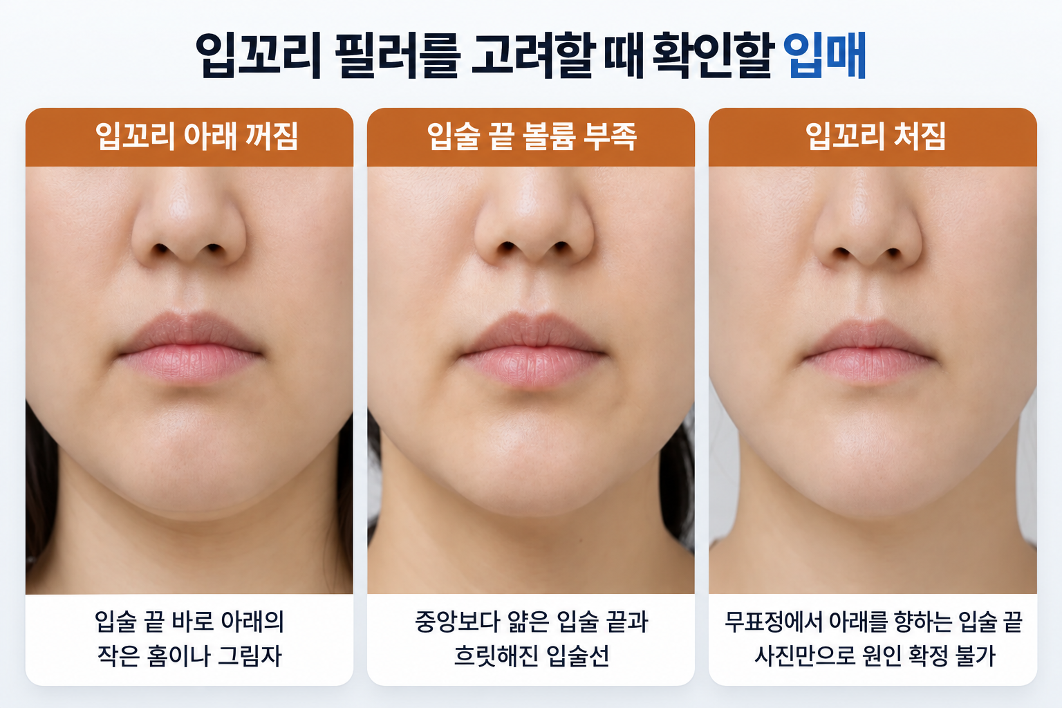 입꼬리 필러 시술 전 살펴보는 입꼬리 아래 꺼짐, 입술 양 끝의 볼륨 부족, 무표정에서 아래로 향하는 입꼬리 형태 비교