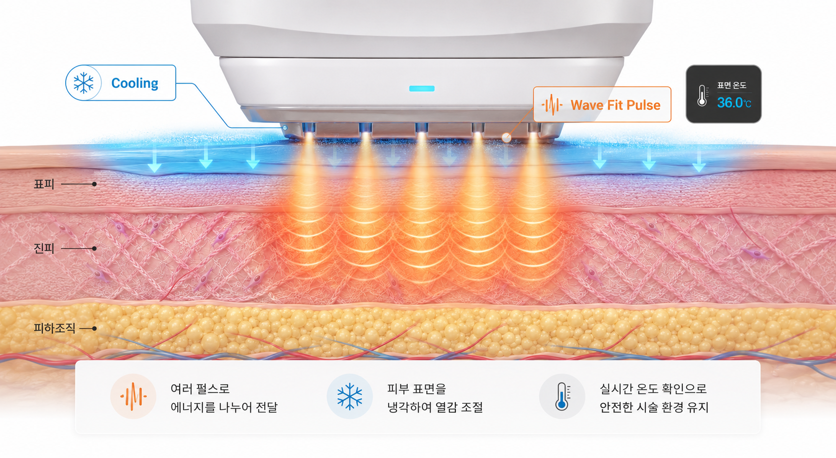 세르프 리프팅 Wave Fit Pulse와 냉각 기능을 이용한 고주파 에너지 전달 원리