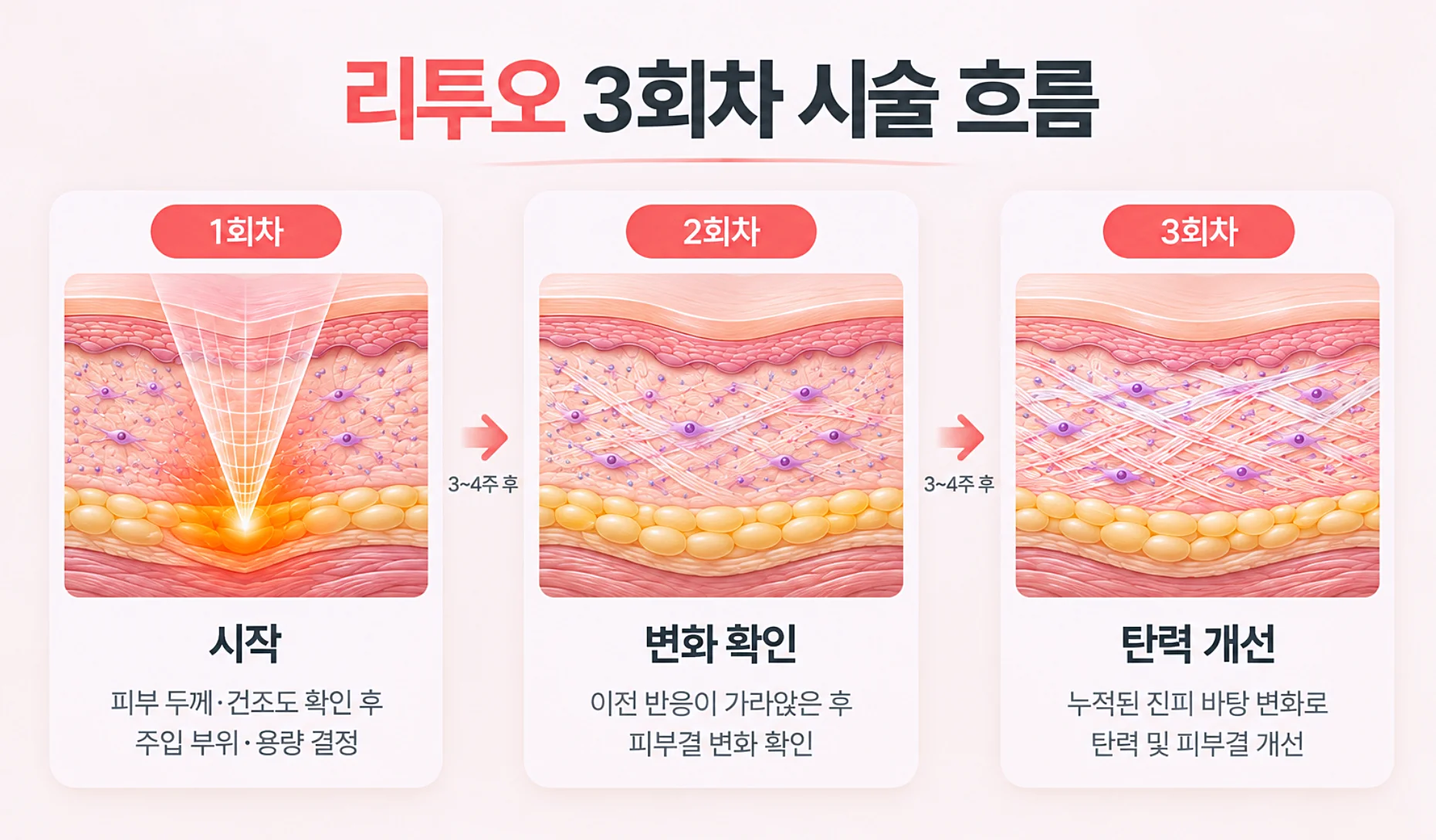 엘라비에 리투오 초기 1~3회차와 추가 회차를 3~4주 간격으로 이어 가는 확인 항목 흐름 이미지