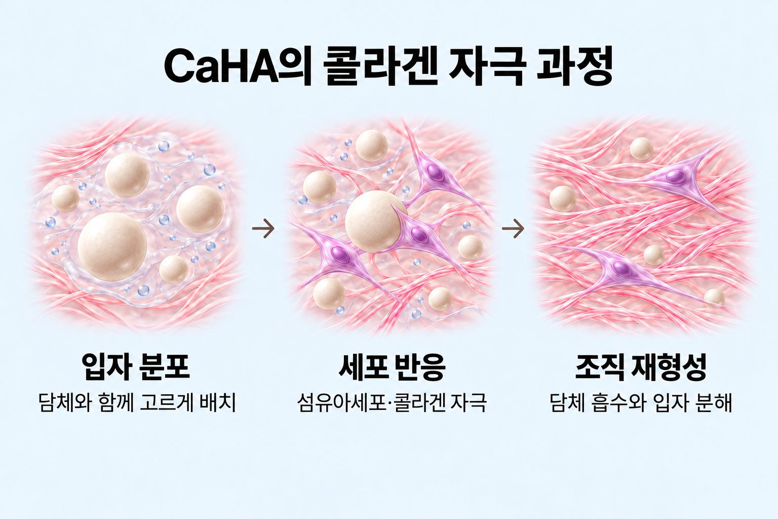 CaHA 입자 분포부터 섬유아세포 반응과 조직 재형성까지의 콜라겐 자극 과정