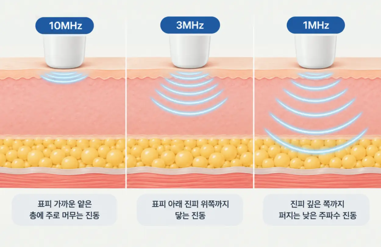LDM 관리가 피부에 작용하는 원리