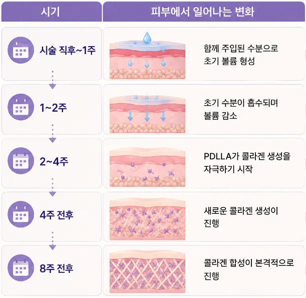 쥬베룩 볼륨 시술 후 콜라겐 생성에 따른 시기별 변화