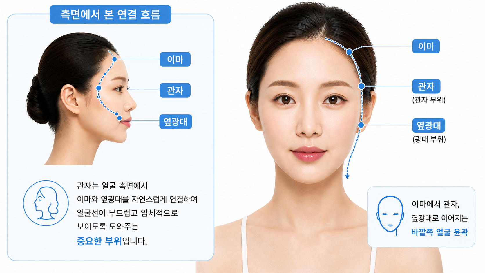 정면과 측면에서 이마·관자·옆광대로 이어지는 얼굴 윤곽과 관자 위치