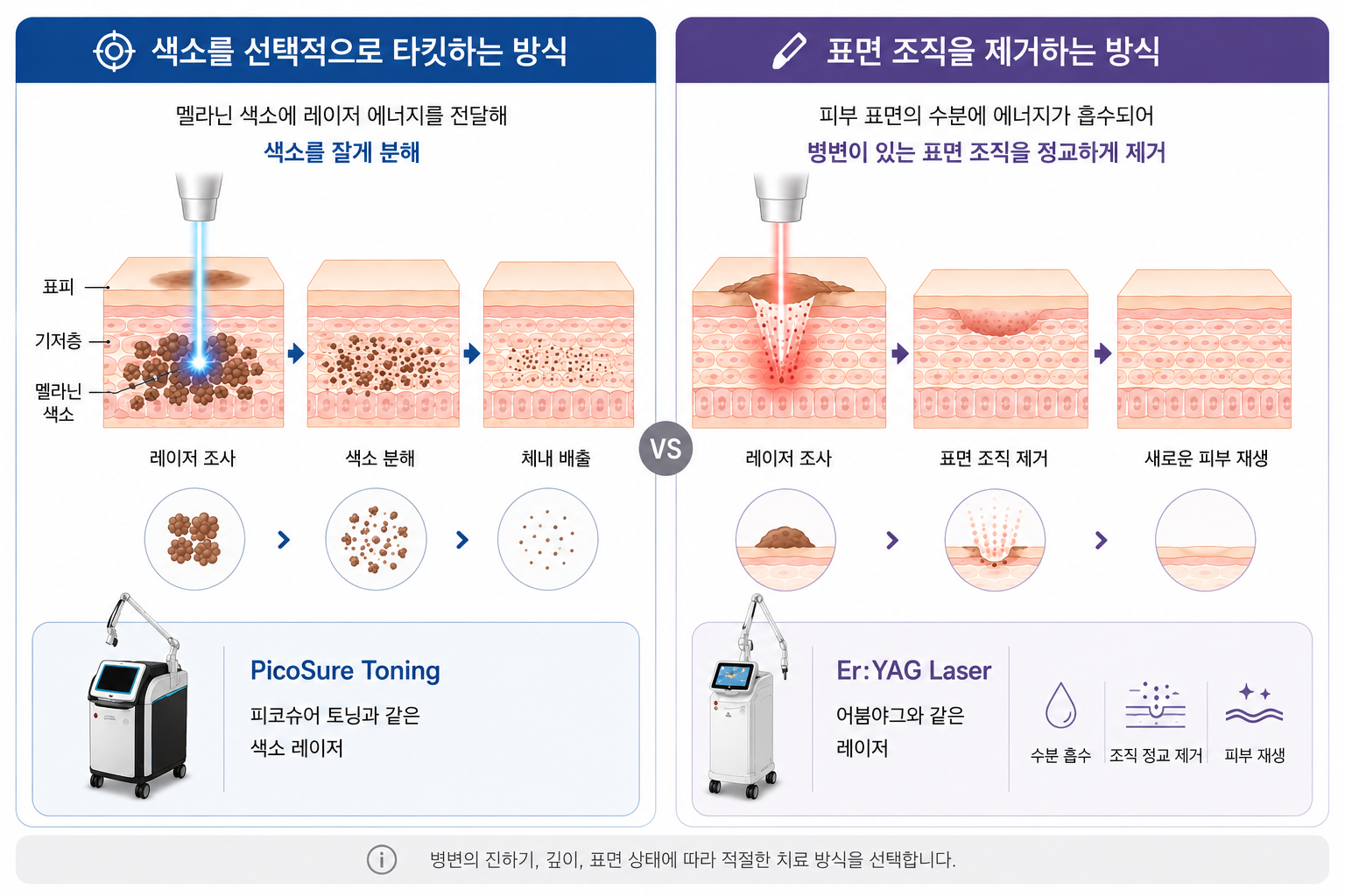 흑자 치료에서 멜라닌 색소를 분해하는 레이저와 표면 조직을 제거하는 어븀야그 방식