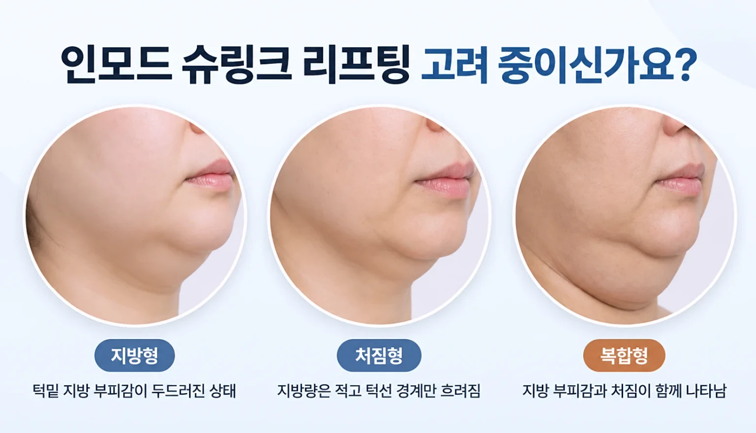 지방형, 처짐형, 복합형으로 나눈 하안면 처짐 유형을 같은 각도로 비교한 부위 사진
