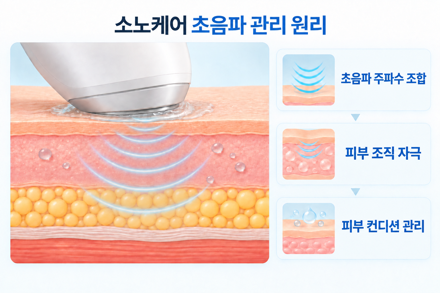 소노케어 핸드피스에서 서로 다른 초음파 주파수를 조합해 피부 조직에 에너지를 전달하고 예민한 피부의 보습·진정 관리를 보조하는 과정
