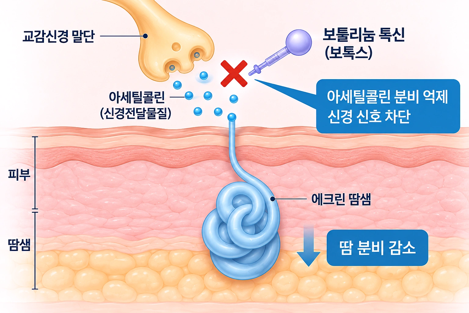 보툴리눔 톡신이 신경 신호를 차단해 땀 분비를 줄이는 다한증 보톡스 원리