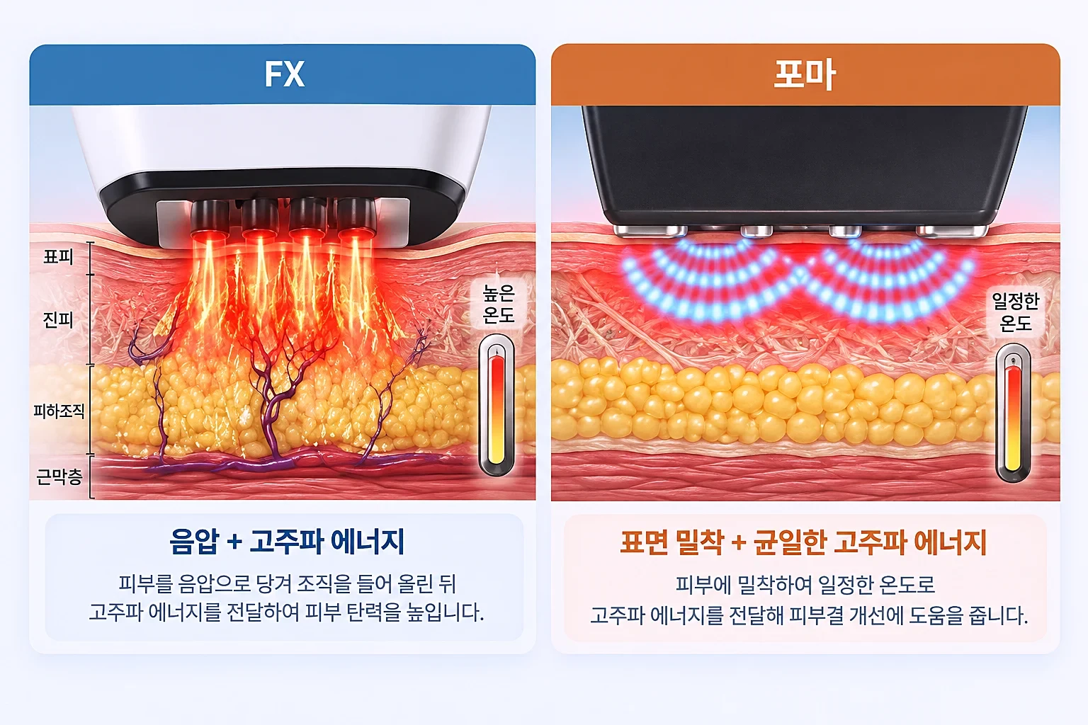 FX 핸드피스의 음압 흡입과 지방층 고주파 전달, 포마의 진피 가열 깊이를 비교한 개념도
