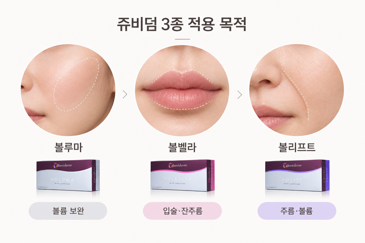 쥬비덤 볼루마 볼벨라 볼리프트 적용 부위와 선택 목적