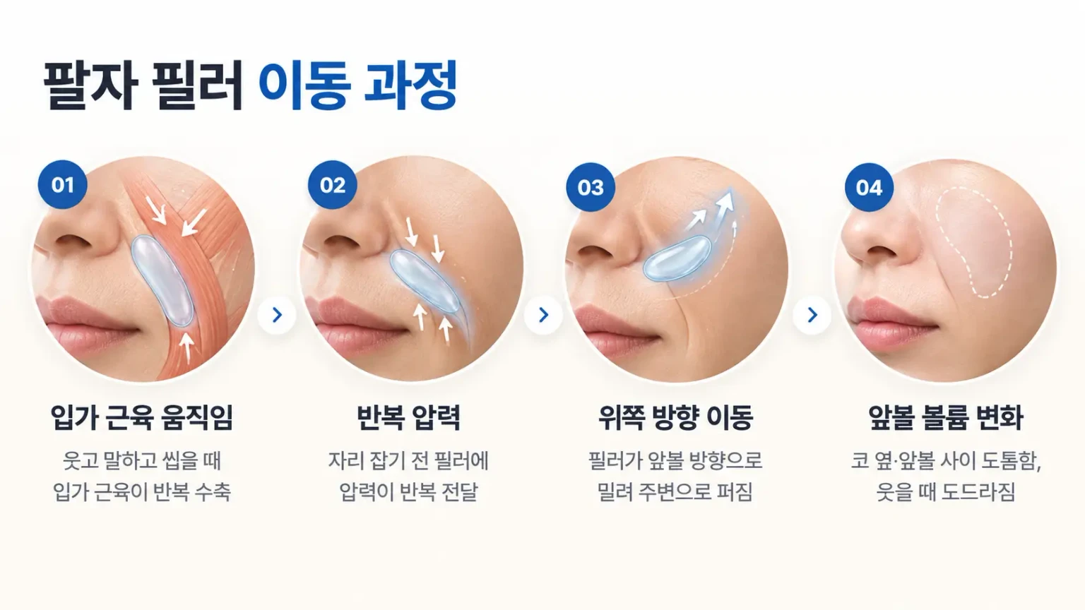 입가 근육 움직임, 반복 압력, 필러의 앞볼 방향 이동과 볼륨 변화를 단계별로 정리한 흐름