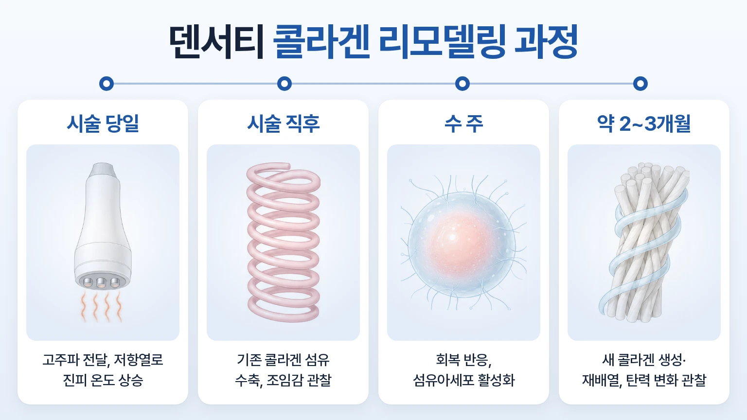 고주파 전달, 콜라겐 수축, 섬유아세포 활성, 새 콜라겐 재배열을 시기별로 정리한 타임라인 이미지