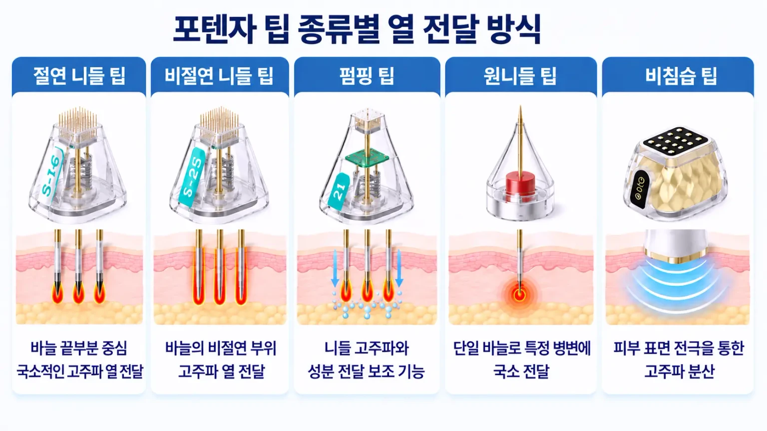 포텐자 팁 5가지 종류와 고주파 열 전달 방식 비교 이미지