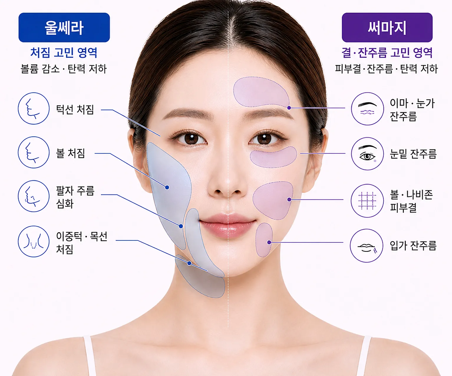 리프팅 고민별 선택 기준 - 턱선 처짐과 잔주름 피부결 구분도