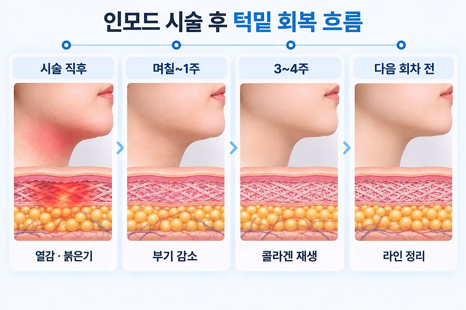 시술 직후 열감부터 며칠 뒤 부기 정리, 2~4주 콜라겐 형성까지 이어지는 회복 흐름