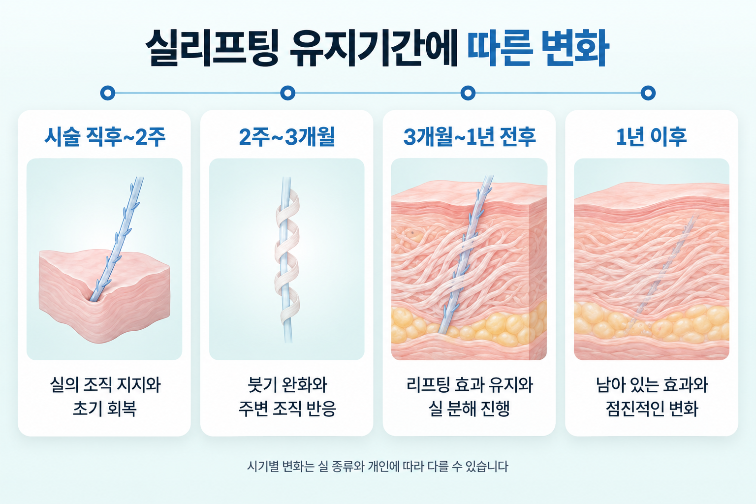 실리프팅 유지기간 동안 시술 직후부터 2주, 2주~3개월, 3개월~1년 전후, 1년 이후까지 실의 조직 지지와 콜라겐 형성 및 흡수 과정
