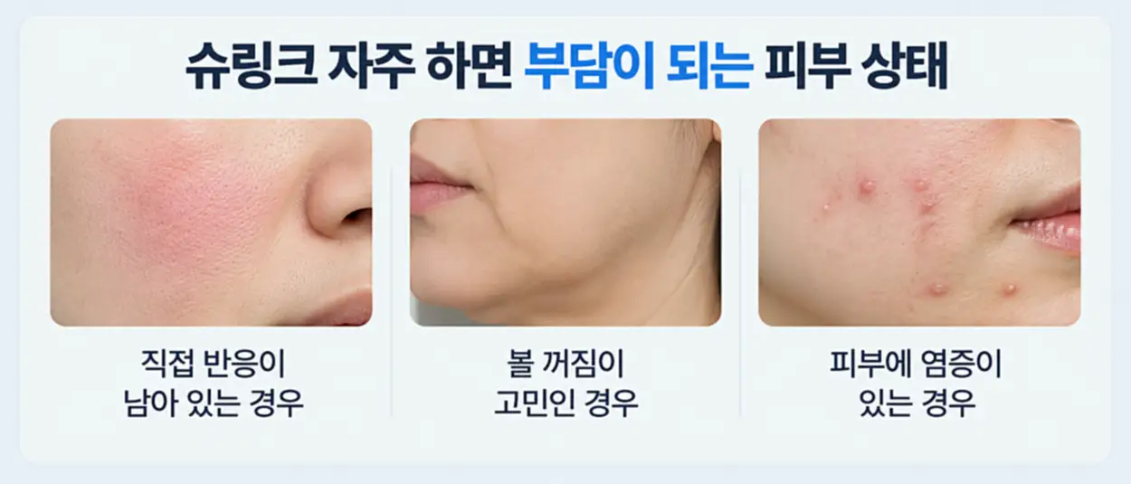 슈링크 자주 하면 안 좋은 피부 상태 3가지