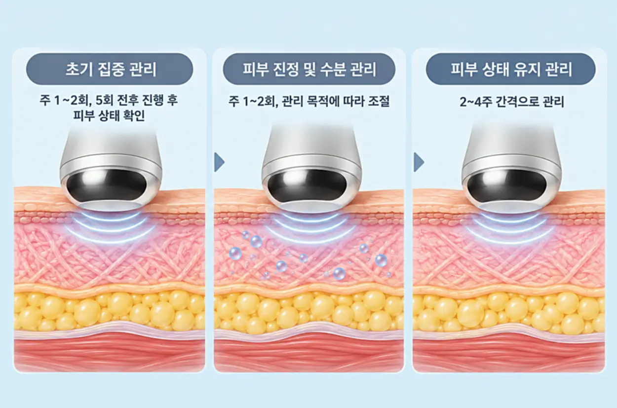 LDM 주기별 피부 관리 인포그래픽, 초기 집중 관리 주 1~2회부터 피부 진정 및 수분 관리, 유지 관리 2~4주 간격까지 피부 단면과 초음파 작용을 단계별로 나타낸 이미지