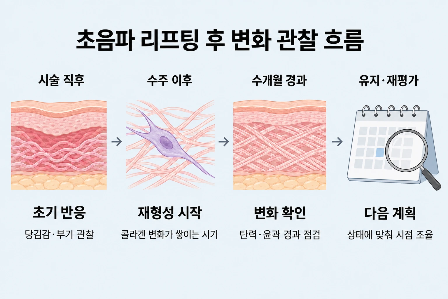 초음파 리프팅 직후부터 콜라겐 재형성, 변화 확인과 재평가까지의 관찰 흐름