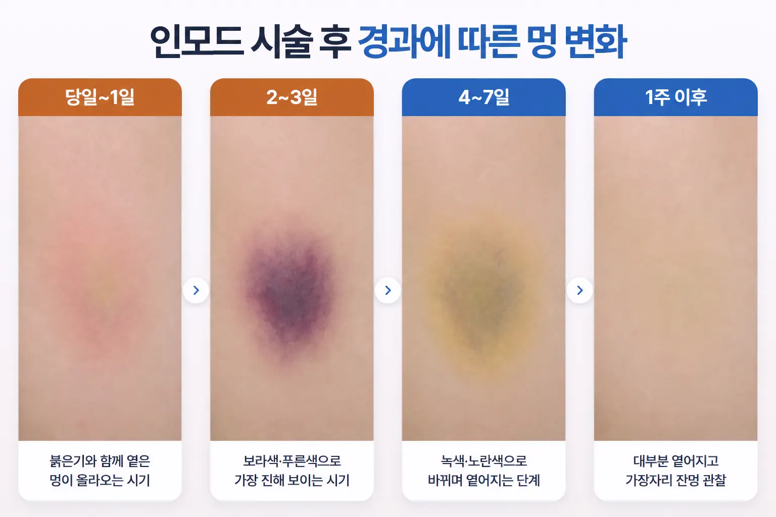 인모드 멍이 붉은 보라색에서 녹색, 노란색으로 시기별로 옅어지는 과정을 담은 피부 비교 사진