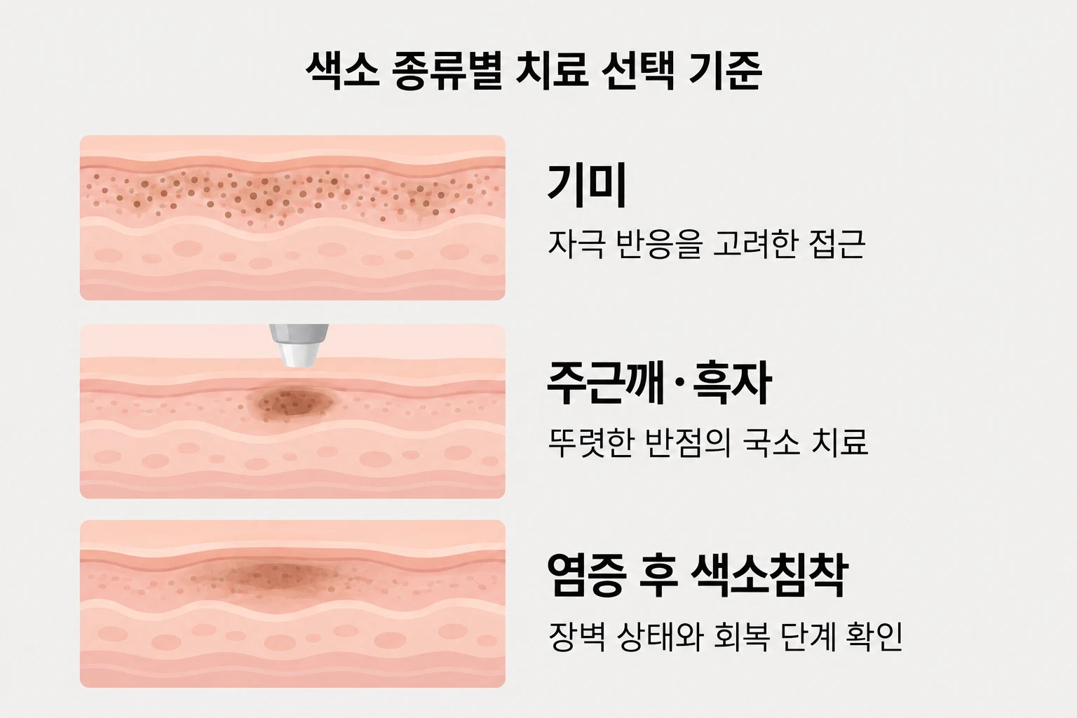 기미·잡티·염증 후 색소침착에 따라 달라지는 치료 선택 기준