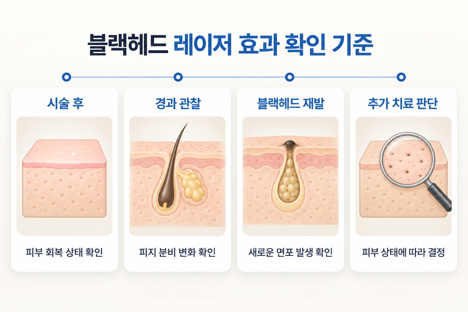 블랙헤드 레이저 후 피부 회복 상태, 피지 분비 변화, 새로운 면포 발생 여부와 추가 치료 판단 기준