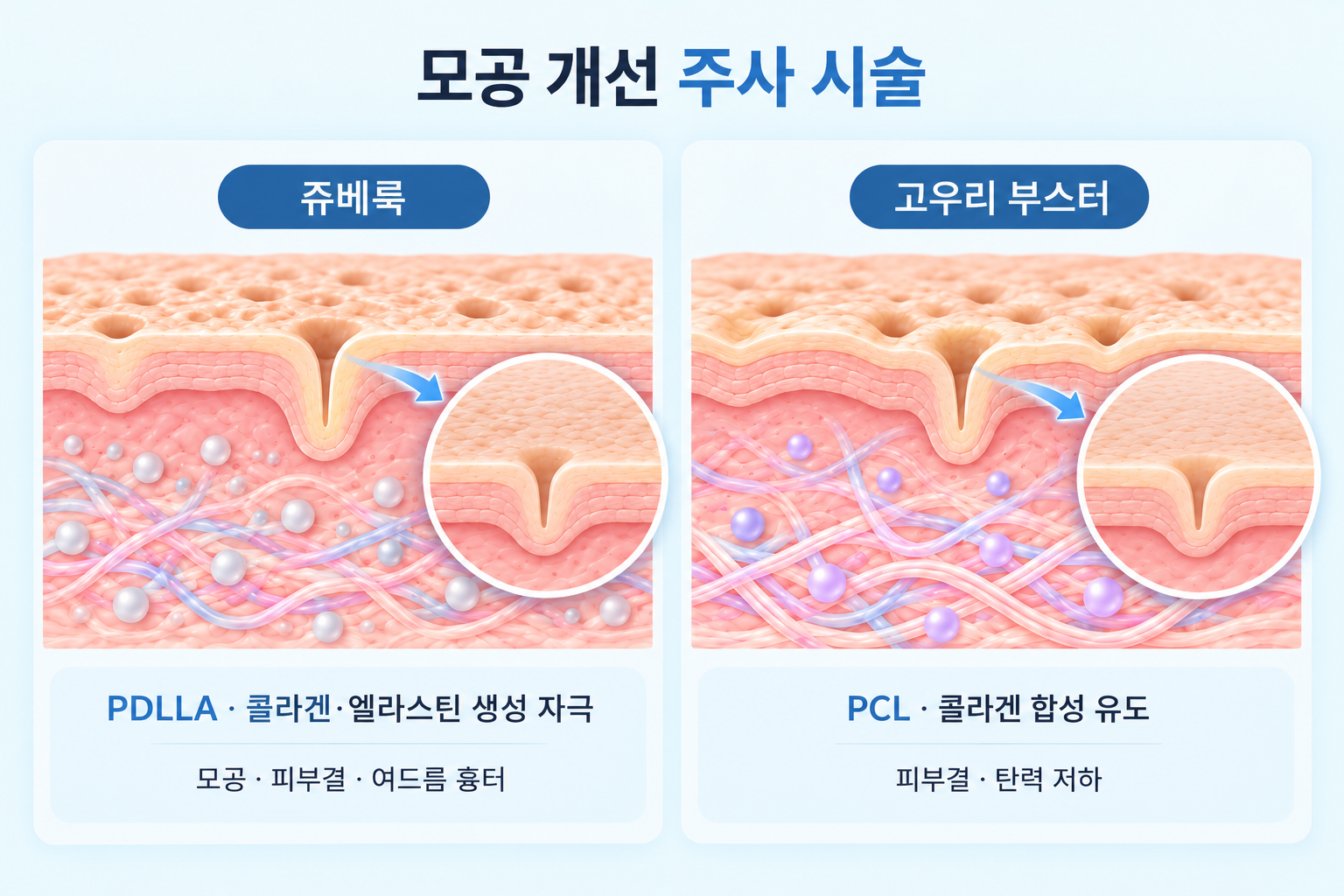 쥬베룩 PDLLA와 고우리 PCL의 콜라겐 생성 원리 비교