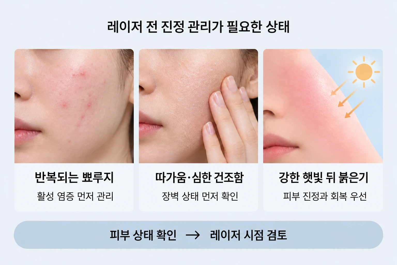 뾰루지·따가움·일광 자극이 있을 때 먼저 살피는 피부 상태