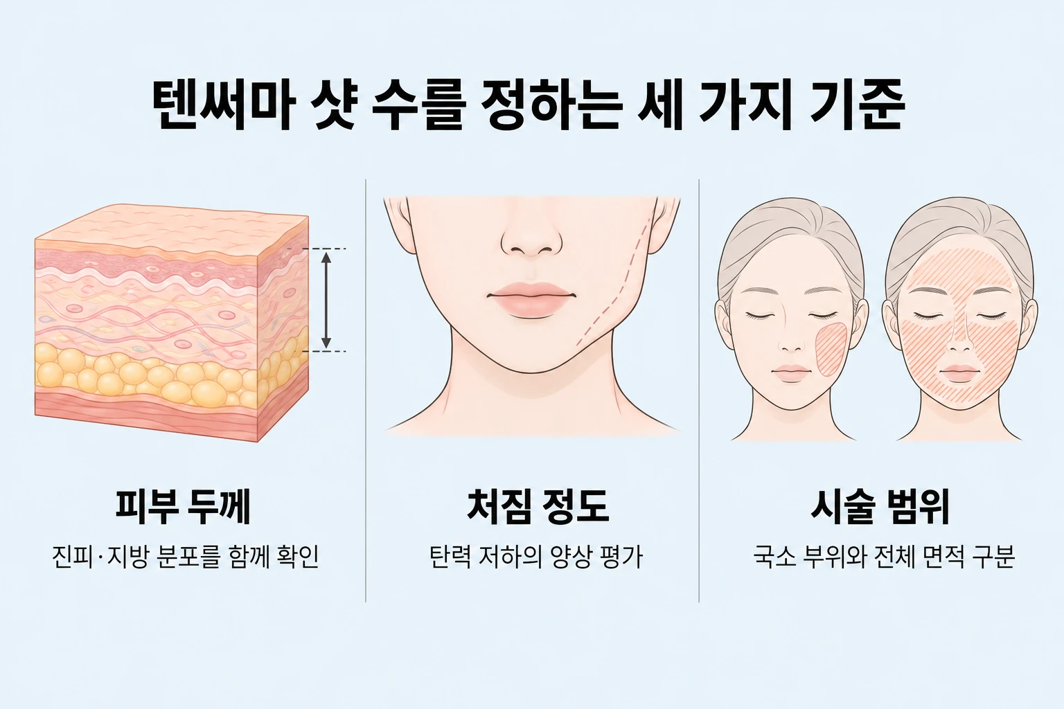텐써마 샷 수 결정 시 확인하는 세 가지 기준인 피부 두께·처짐·시술 범위 안내도