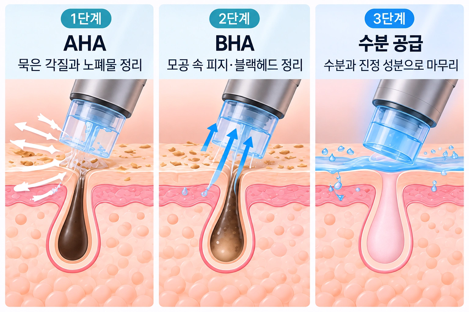 AHA·BHA·수분 공급으로 이어지는 아쿠아필 3단계 과정
