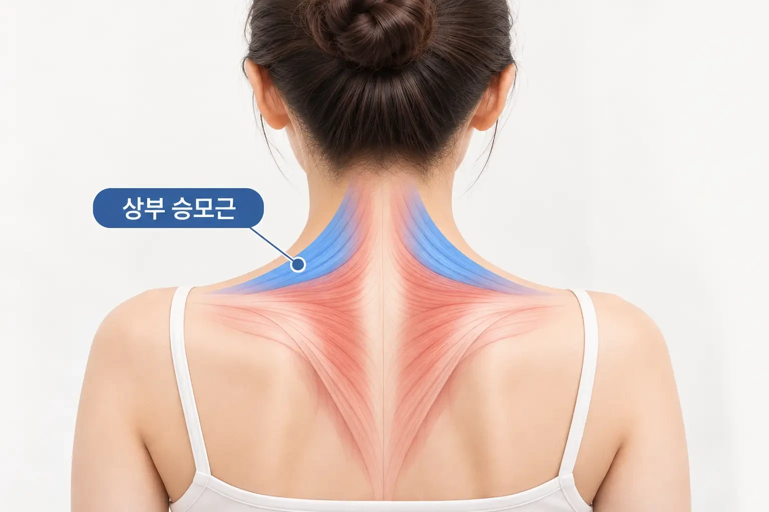 목 뒤에서 어깨로 이어지는 상부 승모근 위치와 근육 구조를 표시한 해부학 이미지