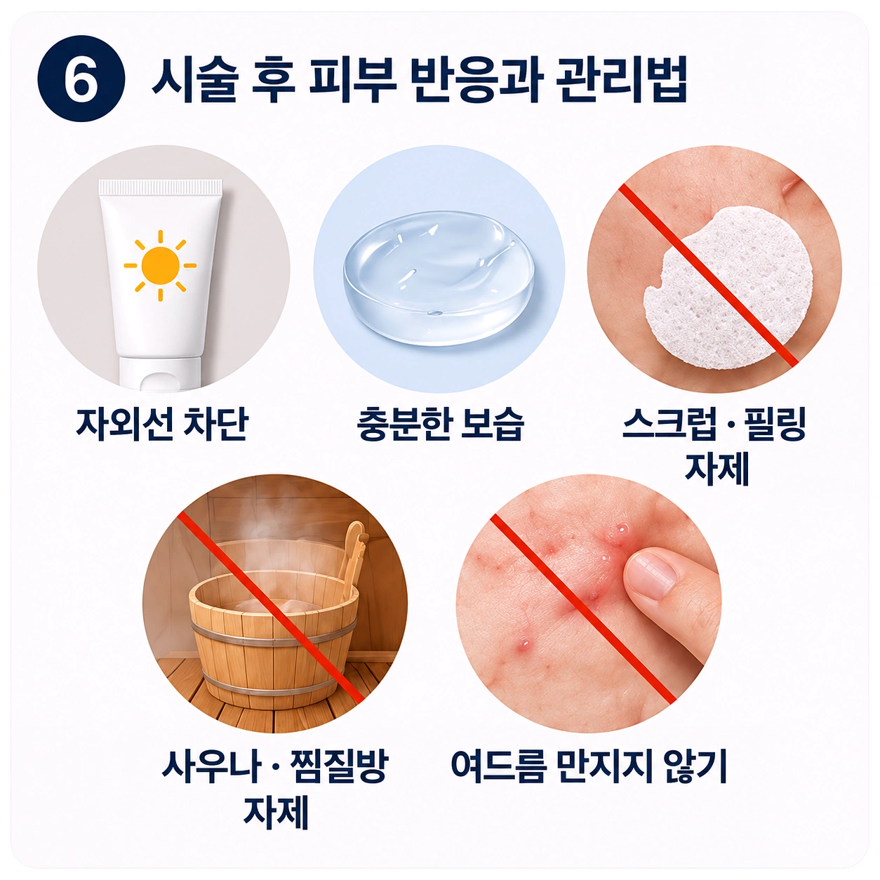 네오빔 레이저 시술 후 피부 자극을 줄이기 위한 관리 방법