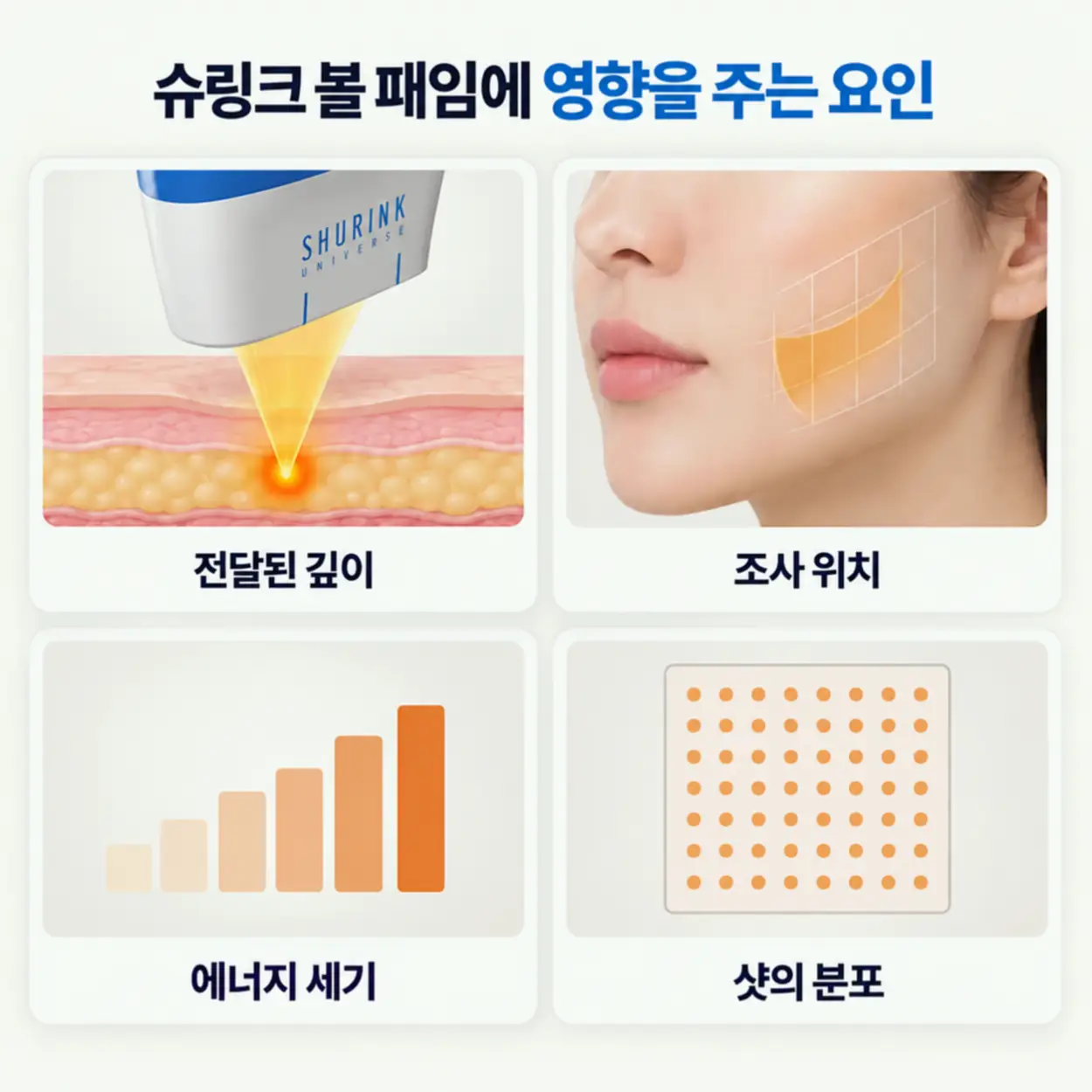 슈링크 볼 패임에 영향을 주는 요인